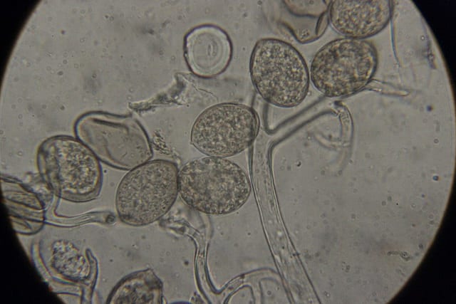 べと病 防除方法とおすすめの使用薬剤 農薬 農業 ガーデニング 園芸 家庭菜園マガジン Agri Pick